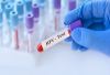 Virus HPV: Từ hiểu biết đến phòng ngừa