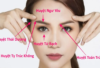Công dụng của các huyệt quanh vùng mắt mà bạn nên biết